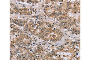 Immunohistochemistry (IHC) image for anti-C-Type Lectin Domain Family 16, Member A (CLEC16A) antibody (ABIN2435086)