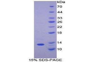 SDS-PAGE (SDS) image for Chemokine (C-C Motif) Ligand 8 (CCL8) (AA 20-94) protein (His tag) (ABIN2125945)