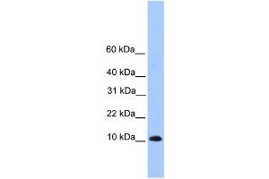 Western Blotting (WB) image for anti-Trafficking Protein Particle Complex 6B (TRAPPC6B) antibody (ABIN2459663) (TRAPPC6B antibody)