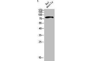 Western blot analysis of RAT-MUSLE lysis using IL4R antibody.
