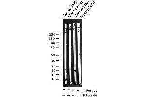 Western blot analysis of Phospho-Stathmin 1 (Ser37) expression in various lysates (Stathmin 1 antibody  (pSer38))