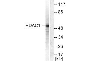 Western blot analysis of extracts from NIH/3T3 cells, using HDAC1 antibody (#C0221). (HDAC1 antibody)