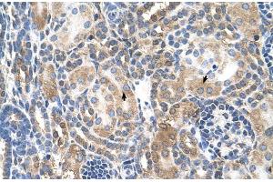 Human kidney (NR3C2 antibody  (Middle Region))