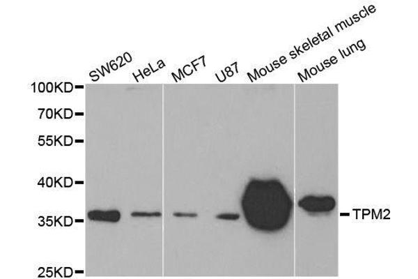 TPM2 antibody