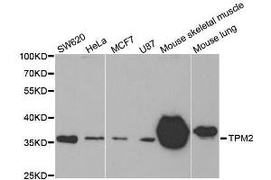Western blot analysis of extracts of various cell lines, using TPM2 antibody. (TPM2 antibody)