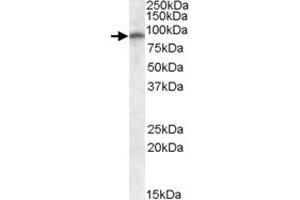 GRIA4 polyclonal antibody  (0. (GRIA4 antibody)