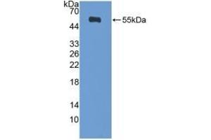 Detection of Recombinant DIAPH1, Human using Polyclonal Antibody to Diaphanous Homolog 1 (DIAPH1) (DIAPH1 antibody  (AA 389-583))