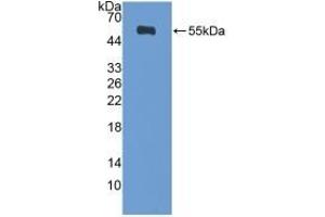 Detection of Recombinant DIAPH1, Human using Polyclonal Antibody to Diaphanous Homolog 1 (DIAPH1)