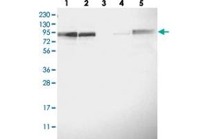Western blot analysis of Lane 1: RT-4, Lane 2: U-251 MG, Lane 3: Human Plasma, Lane 4: Liver, Lane 5: Tonsil with FAM129B polyclonal antibody  at 1:250-1:500 dilution.