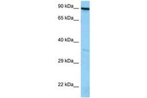 Image no. 1 for anti-FYN-Binding Protein (FYB) (AA 646-695) antibody (ABIN6748302) (FYB antibody  (AA 646-695))