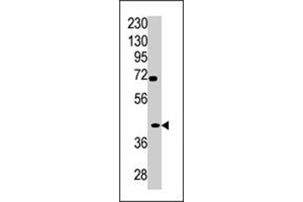 TPST2 antibody  (C-Term)