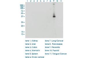 HSD3B1 antibody  (AA 1-373)