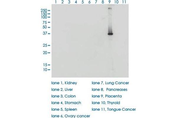 HSD3B1 antibody  (AA 1-373)