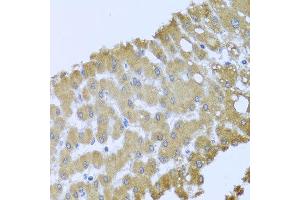 Immunohistochemistry of paraffin-embedded human liver injury using ACP1 antibody at dilution of 1:100 (x40 lens). (ACP1 antibody)