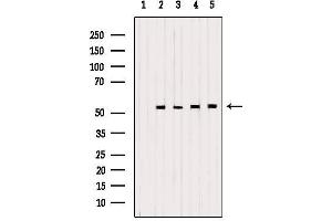 Western blot analysis of extracts from various samples, using PDHX Antibody. (PDHX antibody)
