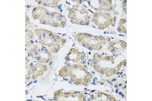 Immunohistochemistry of paraffin-embedded human stomach using SCG3 antibody. (SCG3 antibody  (AA 199-468))