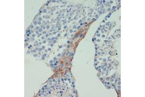 Immunohistochemistry of paraffin-embedded mouse testis using KIF5B antibody (ABIN7268136) at dilution of 1:200 (40x lens). (KIF5B antibody  (AA 650-770))