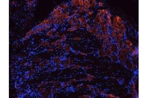 Expression of TrkB in rat DRG - Immunohistochemical staining of rat dorsal root ganglia (DRG) frozen sections using Anti-TrkB (extracellular) Antibody (ABIN7043388, ABIN7044773 and ABIN7044774), (1:100). (TRKB antibody  (Extracellular Domain))