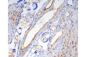 IHC analysis of Caveolin-1/CAV1 using anti-Caveolin-1/CAV1 antibody (ABIN6719534).