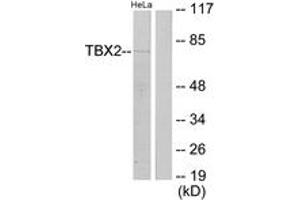 Western blot analysis of extracts from HeLa cells, using TBX2 Antibody. (TBX2 antibody  (AA 251-300))