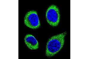 Confocal immunofluorescent analysis of AGBL5 Antibody (N-term) (ABIN655730 and ABIN2845177) with U-251MG cell followed by Alexa Fluor 488-conjugated goat anti-rabbit lgG (green). (AGBL5 antibody  (N-Term))