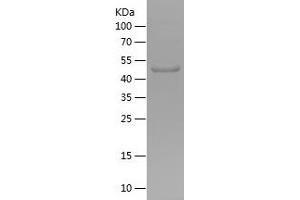 Western Blotting (WB) image for Fucosyltransferase 6 (Alpha (1,3) Fucosyltransferase) (FUT6) (AA 111-332) protein (His-IF2DI Tag) (ABIN7282464) (FUT6 Protein (AA 111-332) (His-IF2DI Tag))
