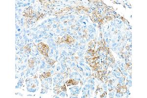 Immunohistochemistry (IHC) image for anti-CD16 (CD16) (AA 21-201) antibody (ABIN7449423) (Recombinant CD16 antibody  (AA 21-201))