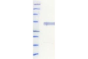 Western Blotting (WB) image for anti-His Tag antibody (ABIN6252928) (His Tag antibody)