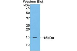 Western blot analysis of the recombinant protein. (Biglycan antibody  (AA 53-166))