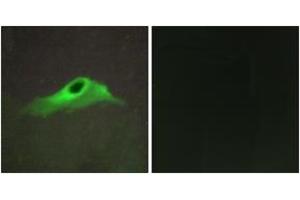 Immunofluorescence analysis of HeLa cells, using Collagen IV alpha5 Antibody. (COL4a5 antibody  (AA 21-70))