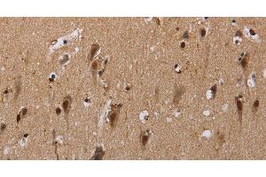 Immunohistochemistry of paraffin-embedded Human brain using GTF2I Polyclonal Antibody at dilution of 1:40 (GTF2I antibody)