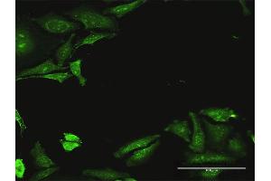 Immunofluorescence of purified MaxPab antibody to CDADC1 on HeLa cell. (CDADC1 antibody  (AA 1-514))