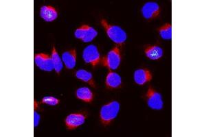 IF analysis of BubR1/BUB1B using anti-BubR1/BUB1B antibody (ABIN7600962).