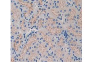 Used in DAB staining on fromalin fixed paraffin- embedded kidney tissue (ABCB9 antibody  (AA 500-762))