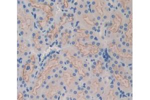 Immunohistochemistry (IHC) image for anti-ATP-Binding Cassette, Sub-Family B (MDR/TAP), Member 9 (ABCB9) (AA 500-762) antibody (ABIN5013190)