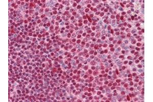 Immunohistochemistry (IHC) image for anti-Cut-Like Homeobox 1 (CUX1) (AA 521-621) antibody (ABIN614596) (CUX1 antibody  (AA 521-621))