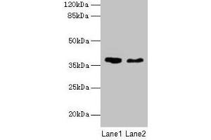 Western blot All lanes: AGA antibody at 10 μg/mL Lane 1: 293T whole cell lysate Lane 2: Mouse muscle tissue Secondary Goat polyclonal to rabbit IgG at 1/10000 dilution Predicted band size: 38 kDa Observed band size: 38 kDa (AGA antibody  (AA 206-346))