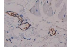 #VALUE! (alpha Fetoprotein antibody  (AA 409-611))