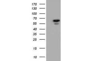 Image no. 6 for anti-Adenylate Kinase 5 (AK5) antibody (ABIN1496535) (Adenylate Kinase 5 antibody)