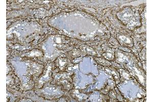 IHC analysis of EHD3 using anti-EHD3 antibody (ABIN7602777). (EHD3 antibody  (C-Term))