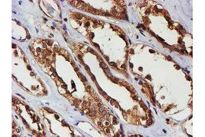 Immunohistochemical staining of paraffin-embedded Human Kidney tissue using anti-PSMB9 mouse monoclonal antibody.