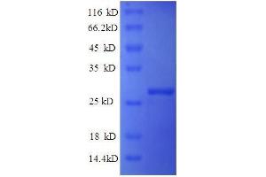 Mannose-Binding Lectin (Protein C) 2, Soluble (MBL2) (AA 26-248), (partial) protein (His tag)