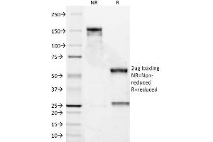 SDS-PAGE Analysis Purified Bcl-2 Mouse Monoclonal Antibody (8C8). (Bcl-2 antibody  (AA 41-54))