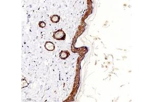 Immunohistochemistry of paraffin embedded rat skin using Palladin (ABIN7074976) at dilution of 1: 1000 (200x lens)