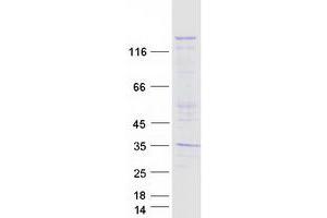 NLR Family, Pyrin Domain Containing 1 (NLRP1) (Transcript Variant 1) protein (Myc-DYKDDDDK Tag)