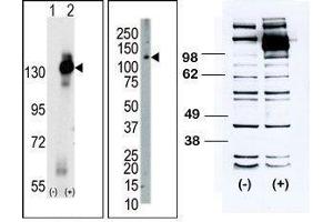 (LEFT) Western blot analysis of CSF1R (arrow) using rabbit polyclonal CSF1R Antibody (C-term).