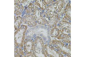 Immunohistochemistry of paraffin-embedded mouse kidney using MMP9 antibody (ABIN4904399) at dilution of 1:100 (40x lens).
