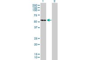 Western Blot analysis of CPB2 expression in transfected 293T cell line by CPB2 MaxPab polyclonal antibody.