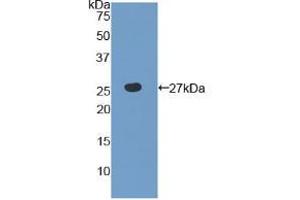 Western blot analysis of recombinant Human TLR6. (TLR6 antibody  (AA 608-796))