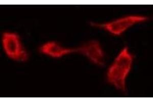 ABIN6269143 staining NIH-3T3 by IF/ICC. (Glycogen Synthase 1 antibody  (C-Term))